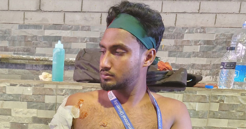 আন্দোলনে আহত ডিআইইউ শিক্ষার্থী মেহেদী হাসান রনি
