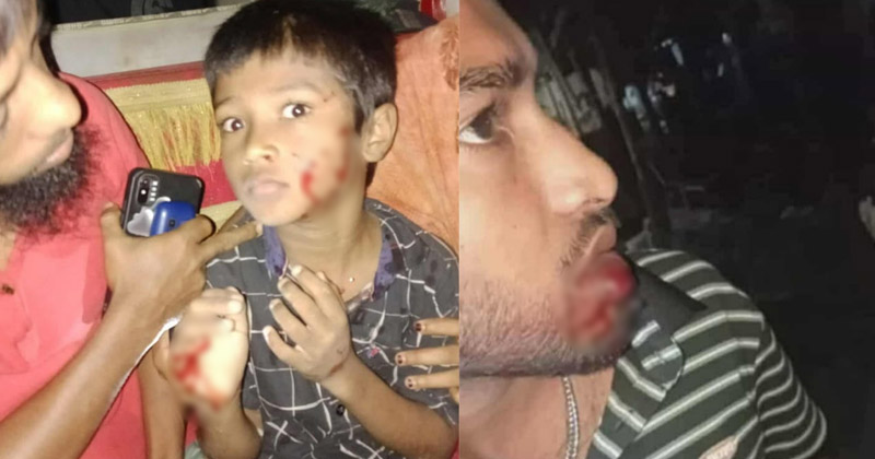 ছবি: প্রতিনিধি