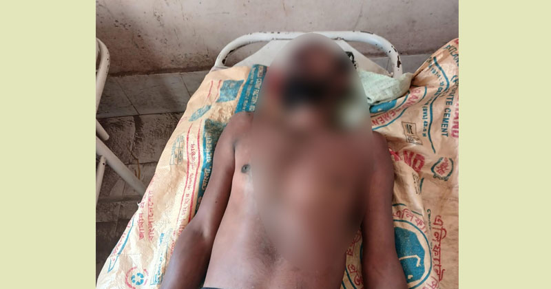 ছবি: প্রতিনিধি